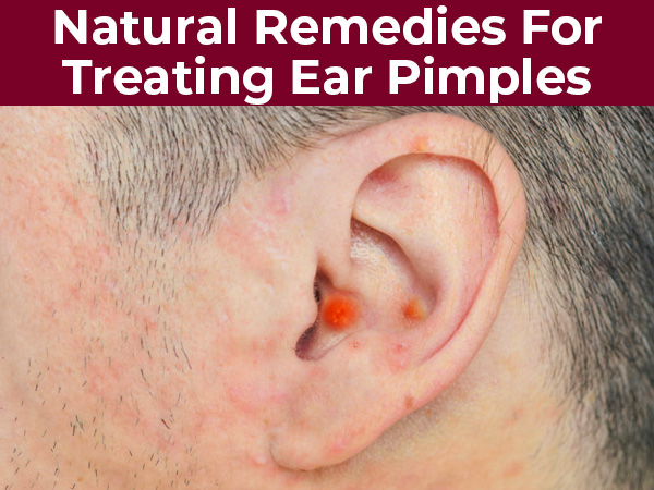 10 Effective Natural Remedies For Treating Ear Pimples Boldsky