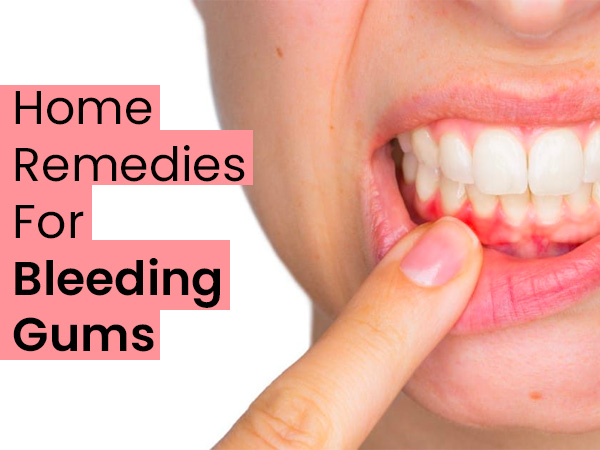 13 Effective Home Remedies For Bleeding Gums