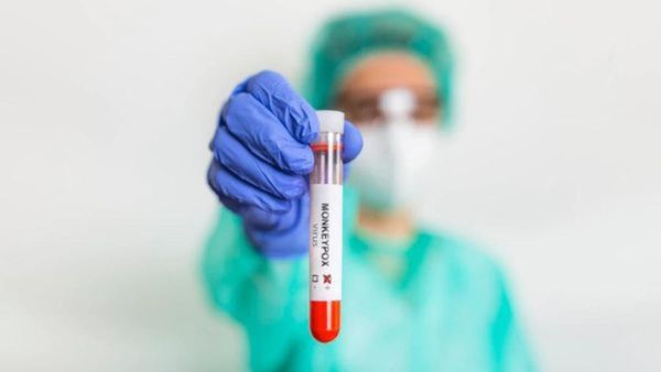 asymptomatic-monkeypox-health-complications-vaccine-and-dos-and-donts asymptomatic-monkeypox-health-complications-vaccine-and-dos-and-donts