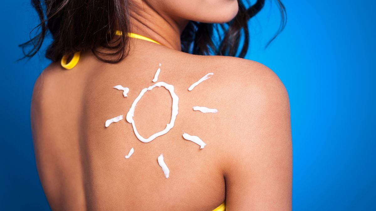 Avoid These Home Remedies For Sunburn