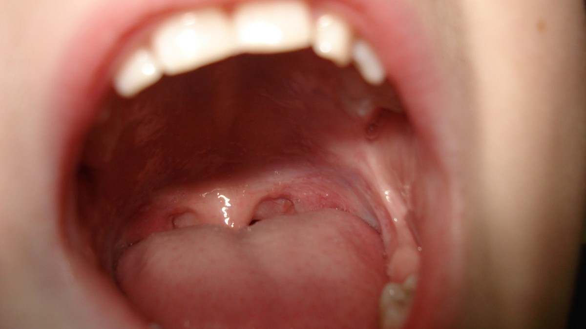 Bad Taste In Mouth How To Fix It, Why It Indicates Multiple Health