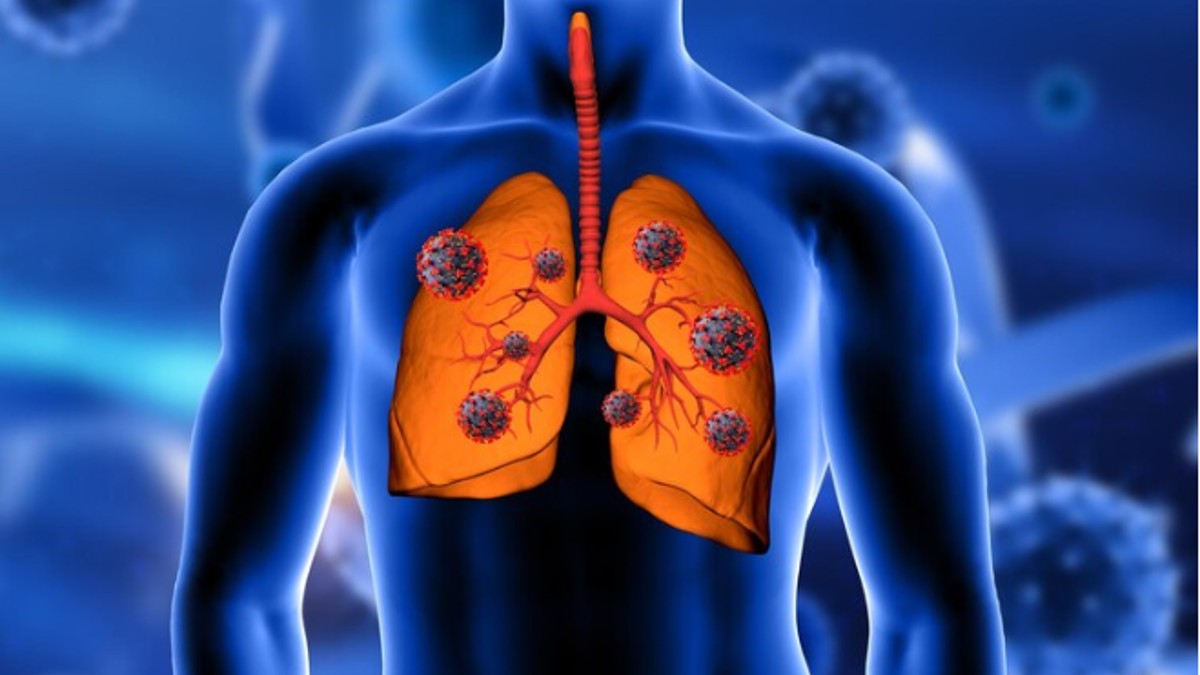 How Poor Oral Health Can Lead to Fatal Lung Disease Like Pneumonia, 6