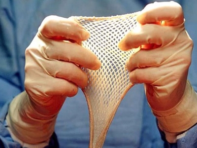 What Is Skin Grafting?