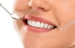 Expert Article: Teeth Cleaning And Polishing - Myths And Facts